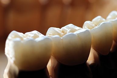 зуби після реставрації в Сумах