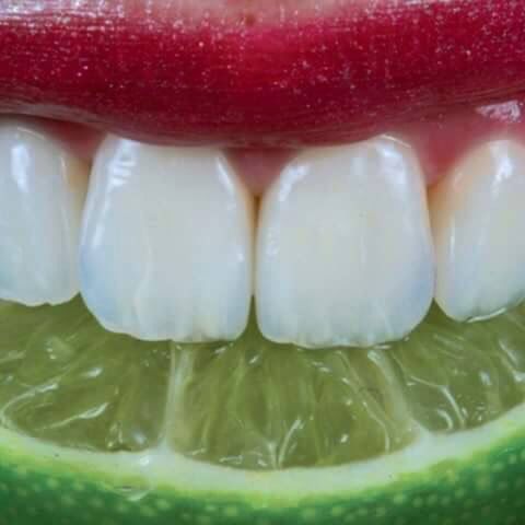 реставрированные зубы